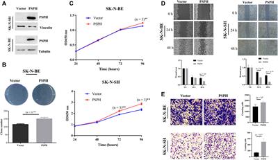 Phosphoserine phosphatase as an indicator for survival through potentially influencing the infiltration levels of immune cells in neuroblastoma